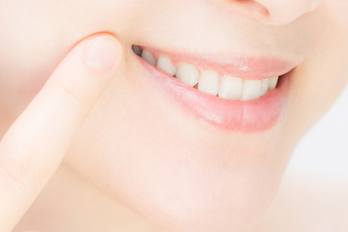 「噛み合わせ」の写真