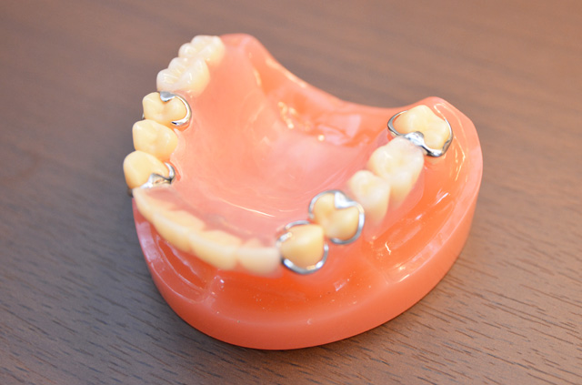 「入れ歯」の写真